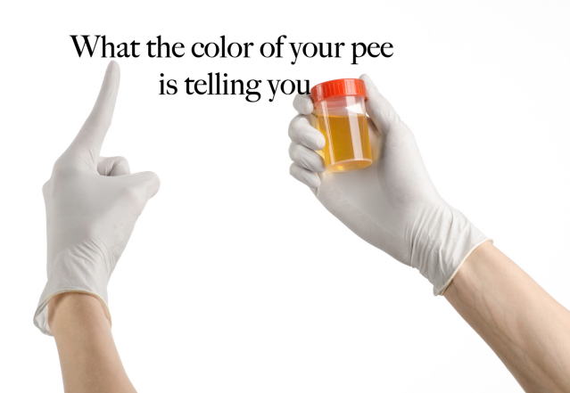 What are the causes of dark and smelly urine?