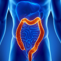 6 Easy Tricks to Reduce Your Risk of Colon Cancer