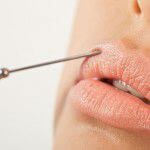 Lip Enhancement Treatment