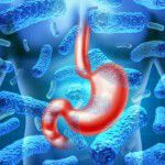 Stomach Infection