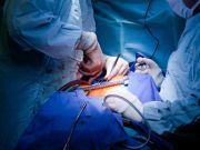 4 Heart Disease Myths Americans Believe