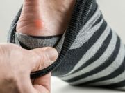 Preventing and Healing Blisters Naturally