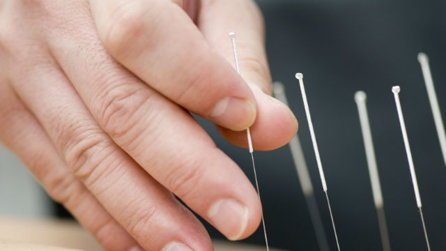 Treatment by acupuncture