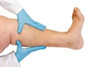 What Your Feet Tell You About the Health of Your Arteries