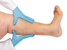 What Your Feet Tell You About the Health of Your Arteries