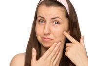 acne