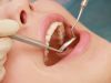 Are Your Dental Fillings Making You Sick?