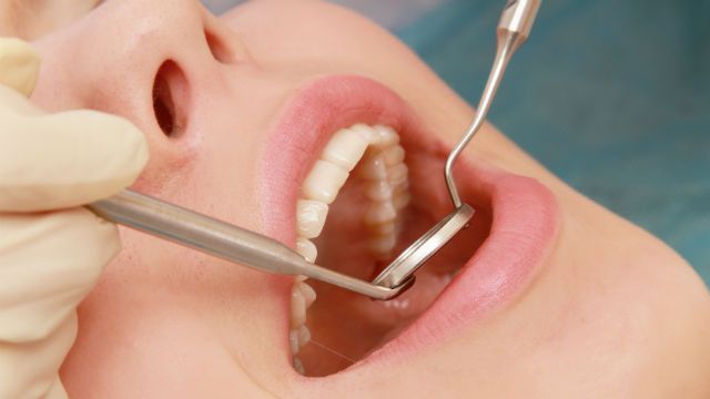 At the dentist's, closeup