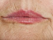 4 Ways to Promote Wrinkles and How to Reduce Them Naturally