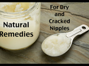 3 Things that Fix Itchy, Cracked Nipples
