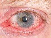 The #1 Oil that Promotes Blindness #1 Worst Oil That Promotes Blindness