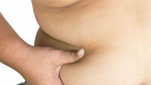 Alarming Fact: Obesity Linked to a Half Million New Cancers Worldwide