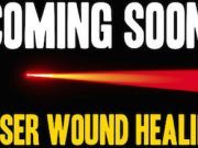 Laser Technology for Wound Healing May Soon Be Fact Not Science Fiction