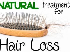 Androgenetic Alopecia: Causes and Natural Treatments That Work