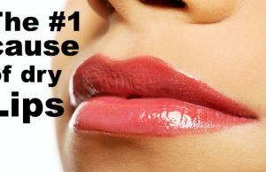 The Secret Causes of Chapped Lips (It’s Not Lip Balm Deficiency!)