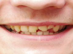 Got a Broken Tooth? Dentists May Someday Be Able to Replace It with Regrown Teeth