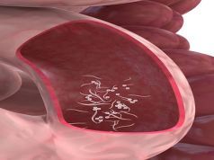 4 Weird Signs That You Have a Parasite