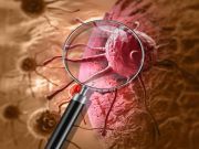 Beware of These Cancer Symptoms That Are Easily Overlooked