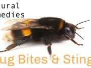 8 Natural DIY Remedies for Summer Bug Bites and Stings