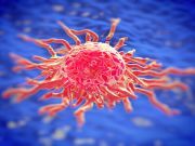 Research Brings Hope for Future Diagnosing of Pancreatic Cancer