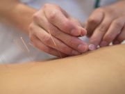 Acupuncture as Effective as Some Antidepressants