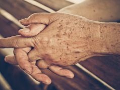 9 Natural Ways to Remove Liver Spots and Age Spots