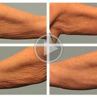 Crepe2_PlayButton_700x440