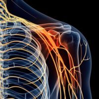 Inflammation_Skeleton