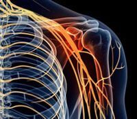 Inflammation_Skeleton2