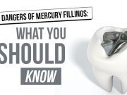 The Dangers Of Mercury Fillings: What You Should Know