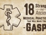 18 Strange And Ancient Medical Practices That Will Make You Gasp