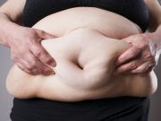 Shocking Four in 10 U.S. Women Now ‘Morbidly’ Overweight