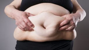 Shocking Four in 10 U.S. Women Now ‘Morbidly’ Overweight
