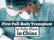 First Full-Body Transplant to Take Place in China