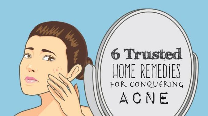 6 Trusted Home Remedies For Conquering Acne