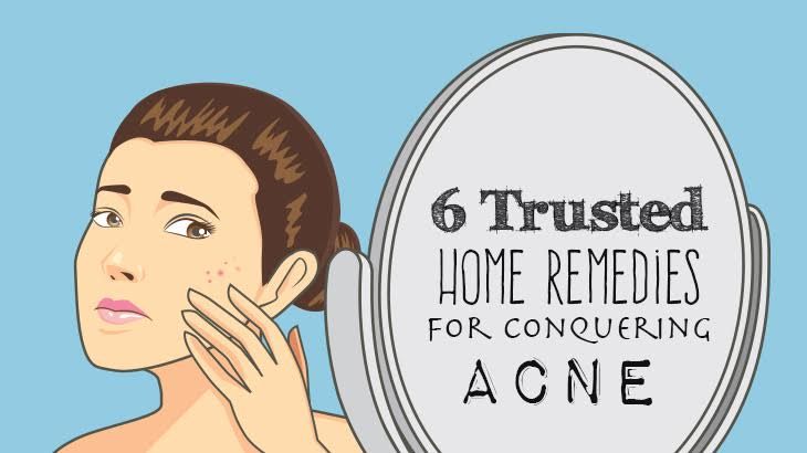 6 Trusted Home Remedies For Conquering Acne