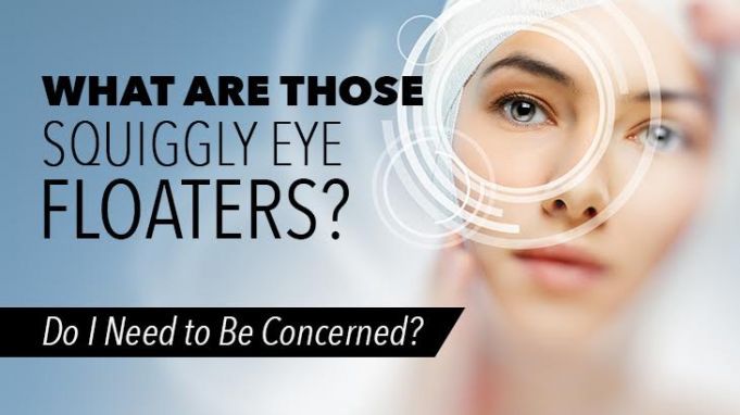 What Are Those Squiggly Eye Floaters? Do I Need to Be Concerned?