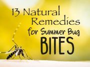 13 Natural Remedies for Summer Bug Bites