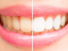 7 Strange Yet Effective Ways to Whiten Your Teeth