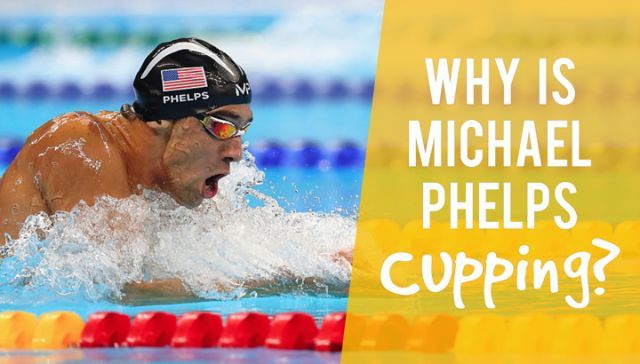 Why Is Michael Phelps Cupping?