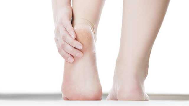 Thryoid Causes Cracked Heels
