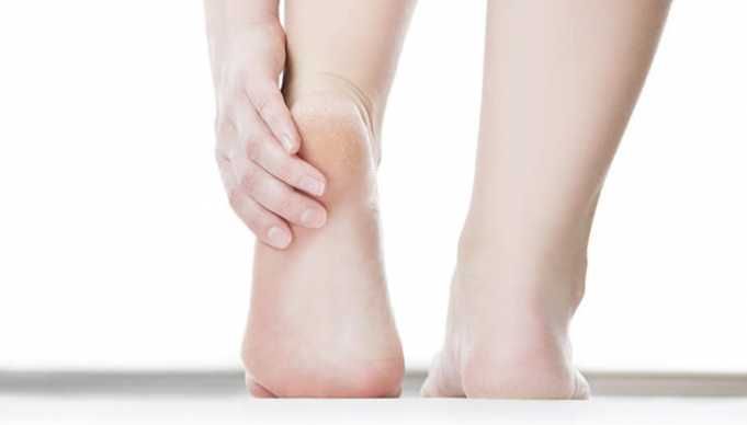 This Could Be The #1 Reason Why Your Heels Are Cracked