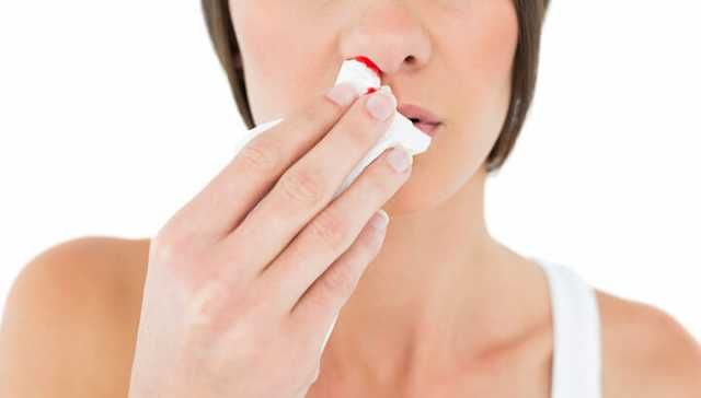 6 Reasons Why Your Nose Bleeds And How To Stop It The Right Way