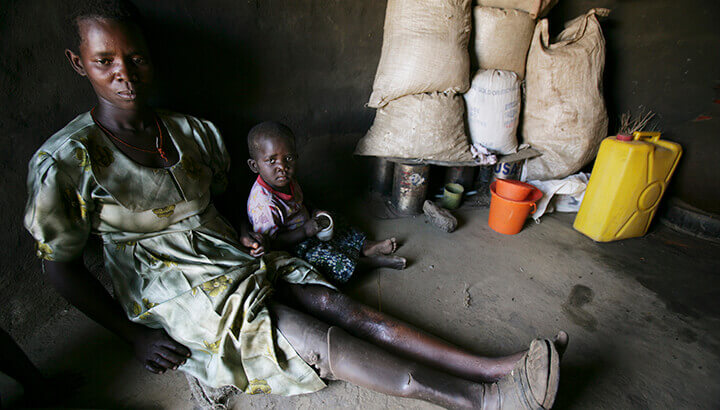 Alcholi people in Uganda were forced to live in unsanitary camps
