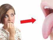 If You Don’t Want Skunk Breath And Herpes, Stop Biting Your Nails