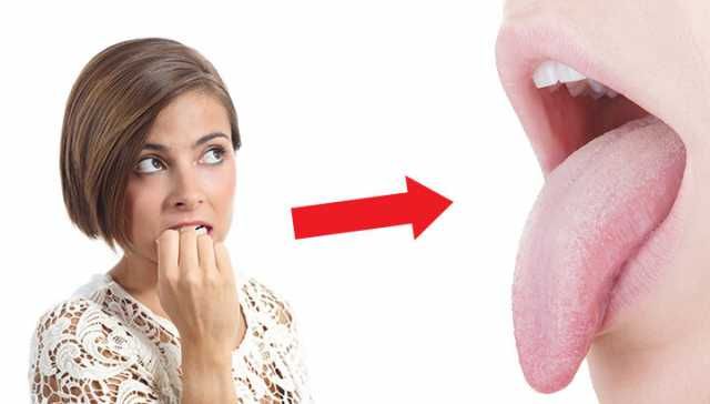 If You Don’t Want Skunk Breath And Herpes, Stop Biting Your Nails