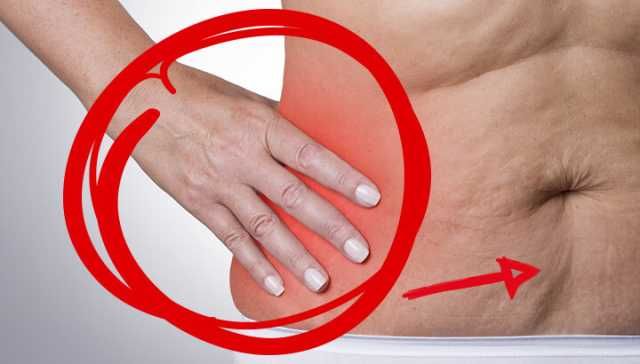 Study Says Inflammation Is Keeping You Fat