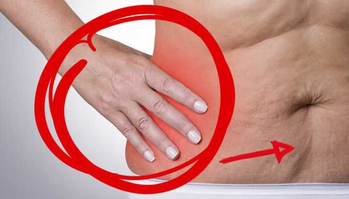 Study Says Inflammation Is Keeping You Fat