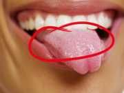 What Your Tongue Scum Is Trying To Tell You