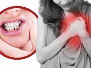 This Tooth Problem Could Cause A Heart Attack